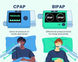 CPAP and BiPAP Setting Recommendation
